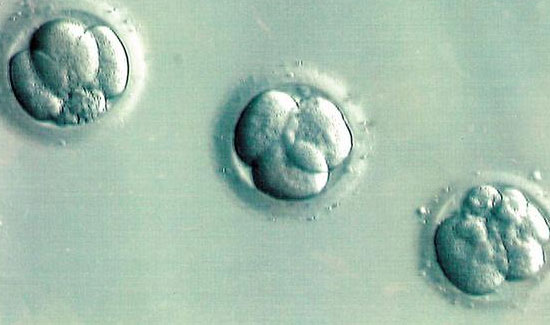 Embryo Donation in Bangalore at Miracle Ivf Hospital 
