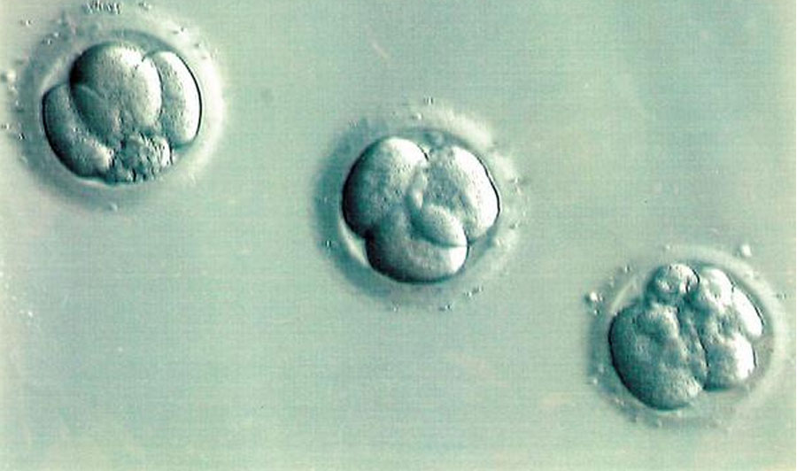 Embryo Donation - Miracle IVF Hospital, Bangalore