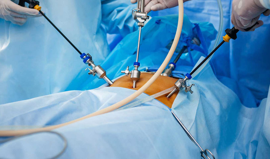 Gynaecological Endoscopy - Miracle IVF Hospital, Bangalore.