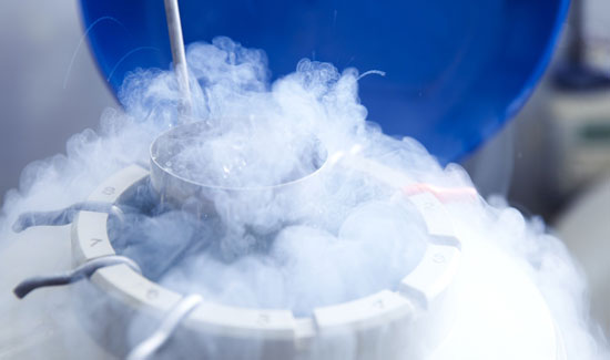 Semen Freezing Services In Bangalore at Miracle Ivf Hospital 