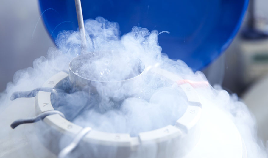 Semen Freezing at Miracle IVF Hospital, Bangalore.